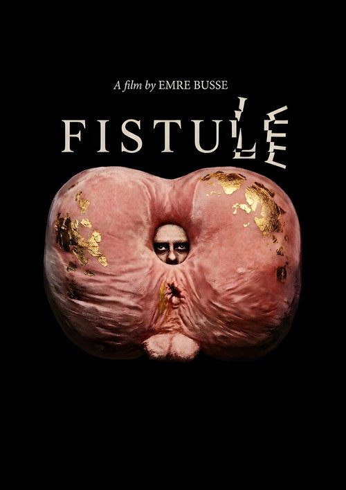 FISTULE — постер
