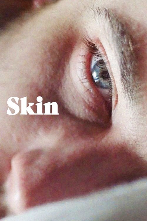 Skin — постер