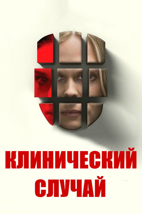 Клинический случай — постер