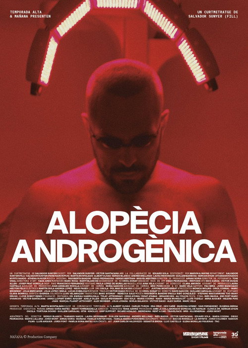 Alopècia androgènica — постер